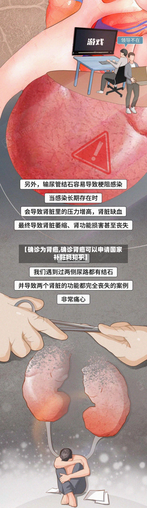 【确诊为肾癌,确诊肾癌可以申请国家补贴吗知乎】-第3张图片