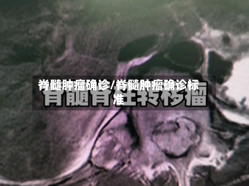 脊髓肿瘤确诊/脊髓肿瘤确诊标准