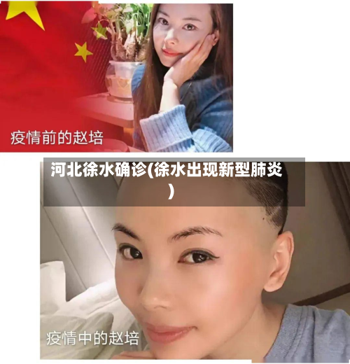河北徐水确诊(徐水出现新型肺炎)-第3张图片