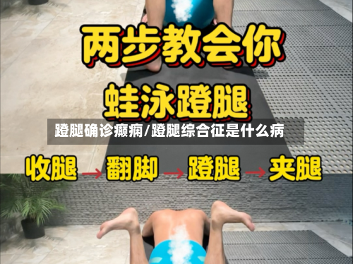 蹬腿确诊癫痫/蹬腿综合征是什么病-第2张图片