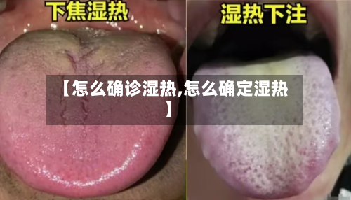【怎么确诊湿热,怎么确定湿热】-第3张图片