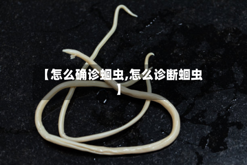 【怎么确诊蛔虫,怎么诊断蛔虫】-第2张图片