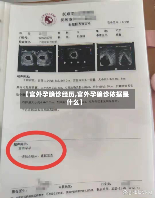 【宫外孕确诊经历,宫外孕确诊依据是什么】