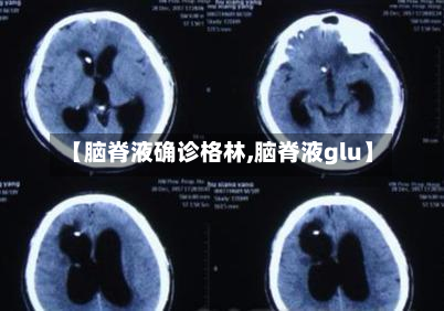 【脑脊液确诊格林,脑脊液glu】