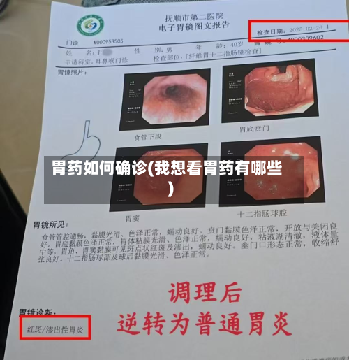 胃药如何确诊(我想看胃药有哪些)