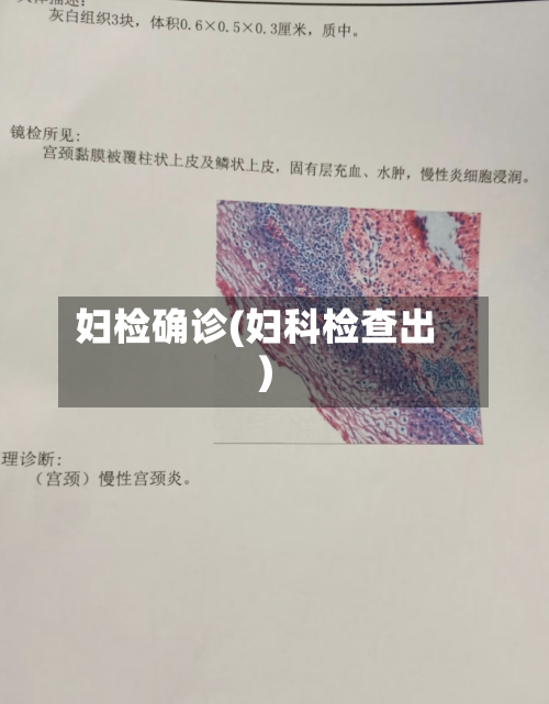妇检确诊(妇科检查出)-第2张图片