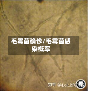 毛霉菌确诊/毛霉菌感染概率-第2张图片