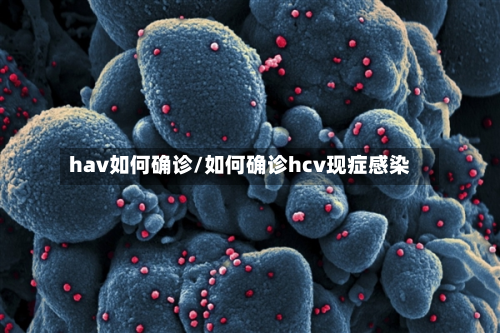 hav如何确诊/如何确诊hcv现症感染-第3张图片