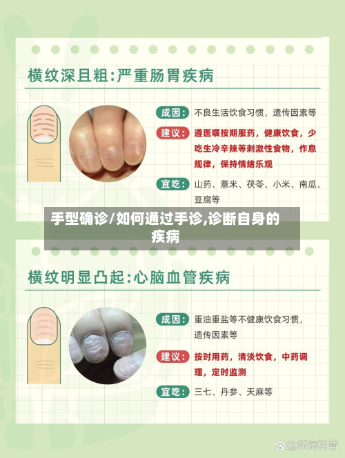 手型确诊/如何通过手诊,诊断自身的疾病
