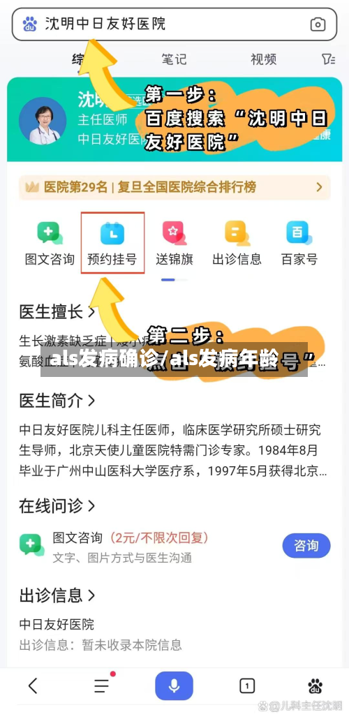 als发病确诊/als发病年龄-第3张图片