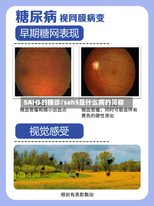 SAHS的确诊/sahS是什么病的简称