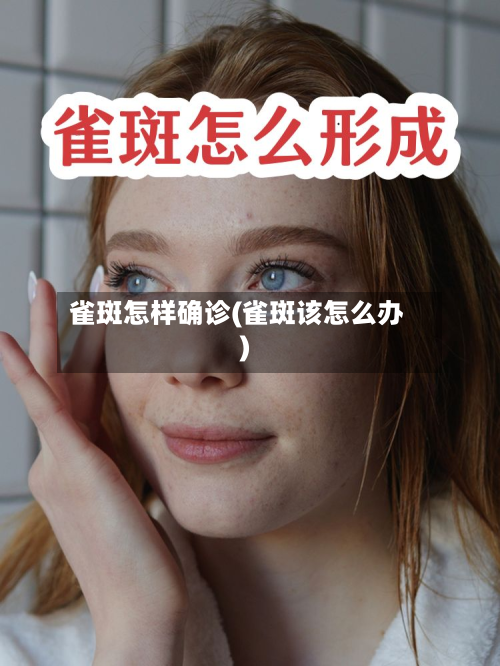 雀斑怎样确诊(雀斑该怎么办)-第2张图片