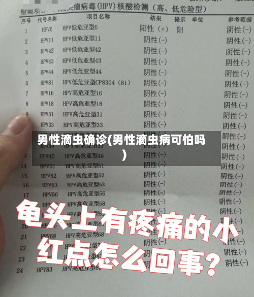 男性滴虫确诊(男性滴虫病可怕吗)-第3张图片