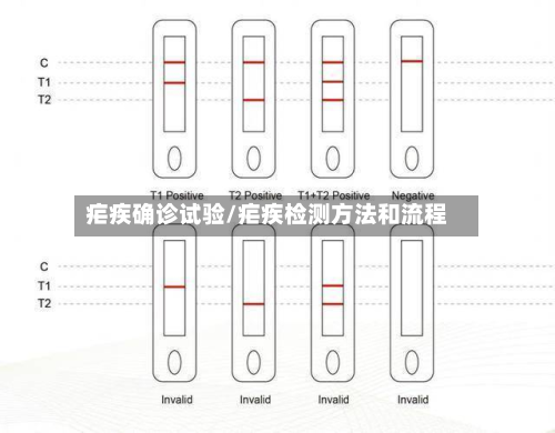 疟疾确诊试验/疟疾检测方法和流程