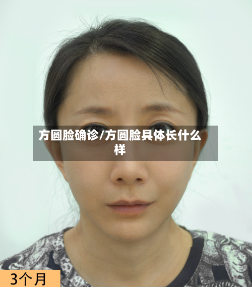 方圆脸确诊/方圆脸具体长什么样-第2张图片