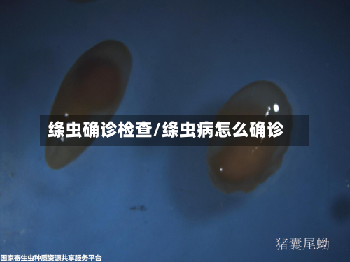 绦虫确诊检查/绦虫病怎么确诊-第3张图片