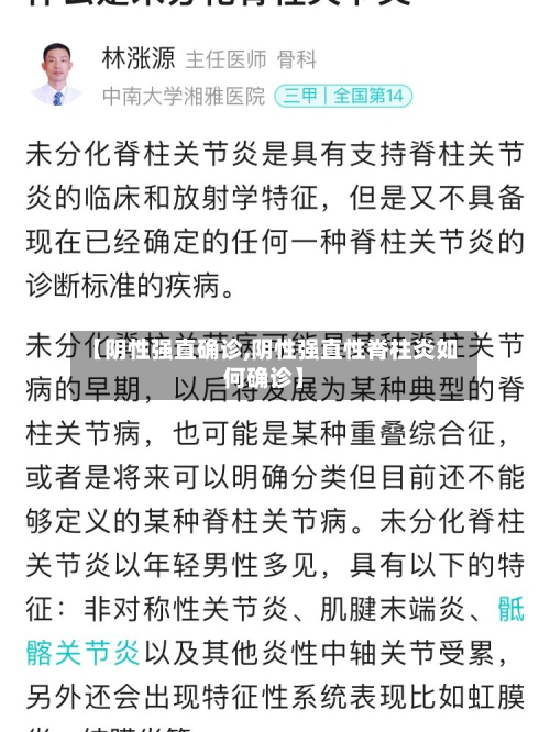 【阴性强直确诊,阴性强直性脊柱炎如何确诊】