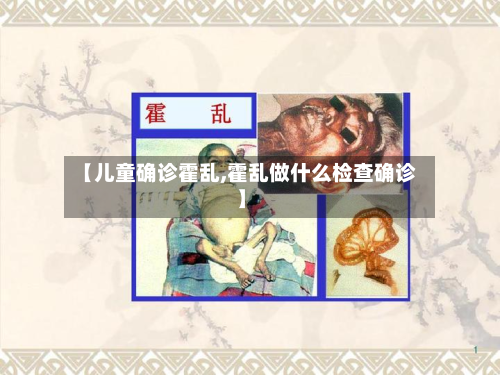【儿童确诊霍乱,霍乱做什么检查确诊】-第2张图片