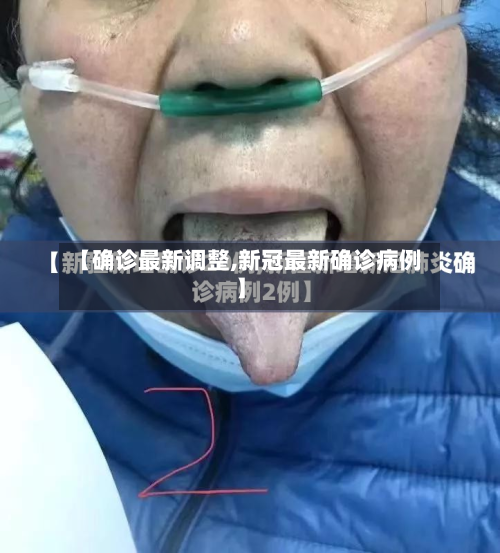 【确诊最新调整,新冠最新确诊病例】-第3张图片