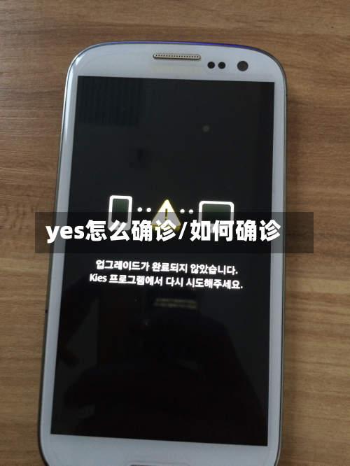 yes怎么确诊/如何确诊-第2张图片
