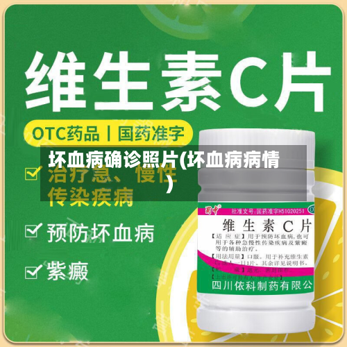 坏血病确诊照片(坏血病病情)-第2张图片