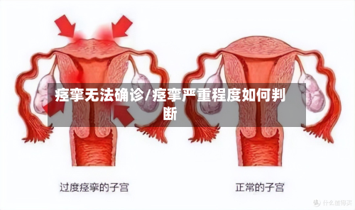 痉挛无法确诊/痉挛严重程度如何判断