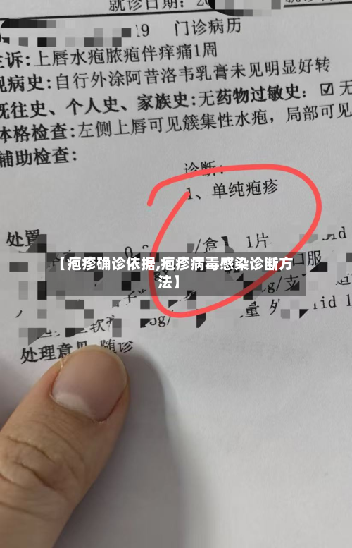 【疱疹确诊依据,疱疹病毒感染诊断方法】