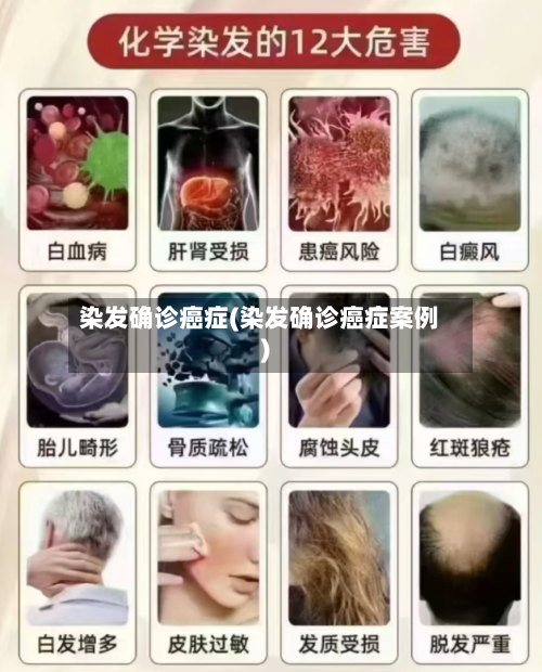 染发确诊癌症(染发确诊癌症案例)-第2张图片