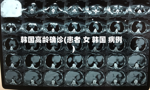 韩国高龄确诊(患者 女 韩国 病例)