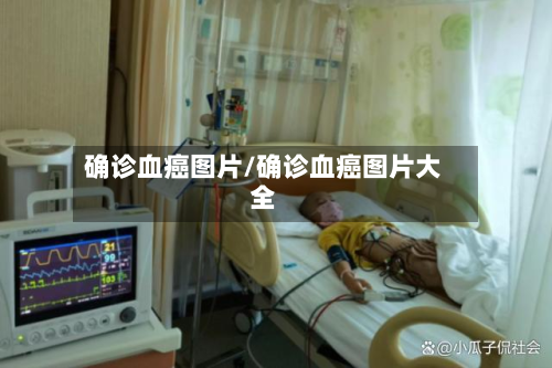 确诊血癌图片/确诊血癌图片大全-第2张图片