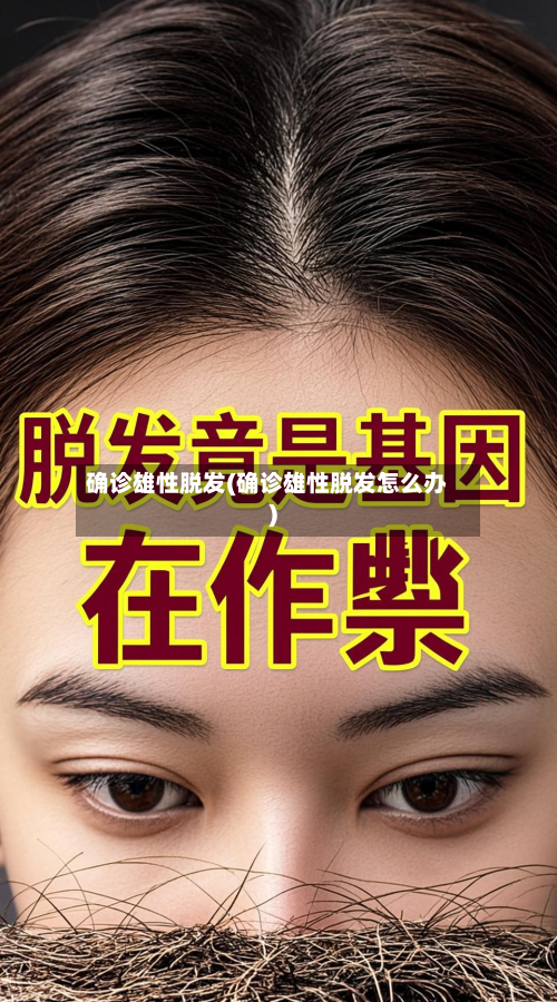 确诊雄性脱发(确诊雄性脱发怎么办)