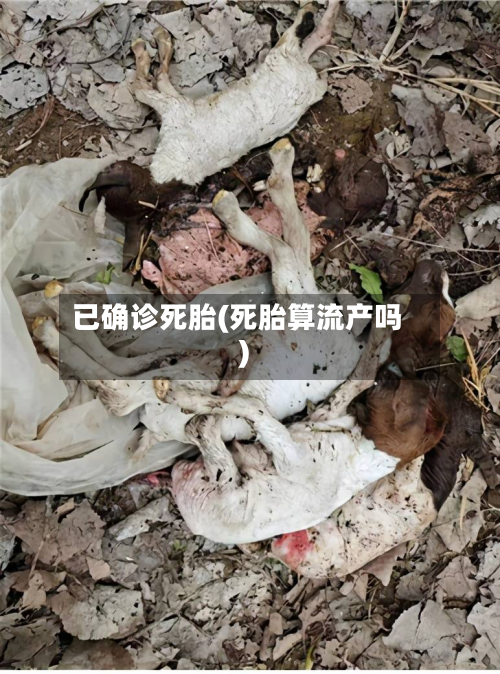 已确诊死胎(死胎算流产吗)-第2张图片