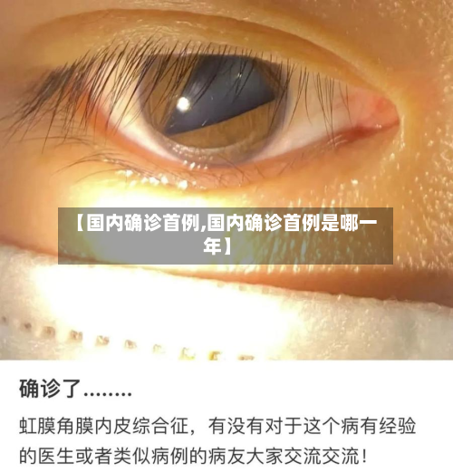 【国内确诊首例,国内确诊首例是哪一年】-第3张图片