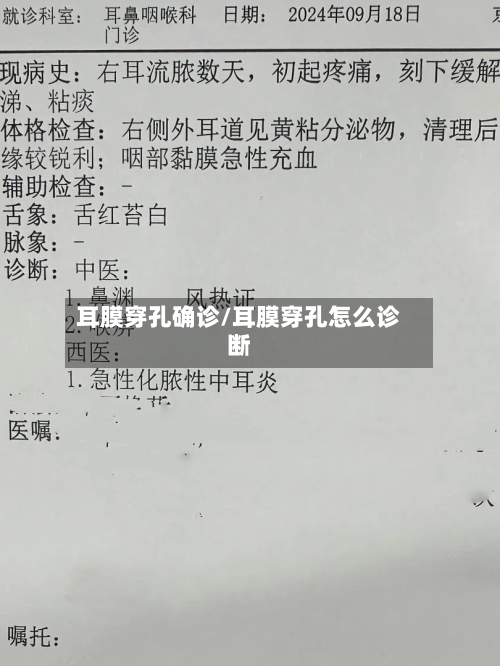 耳膜穿孔确诊/耳膜穿孔怎么诊断-第2张图片