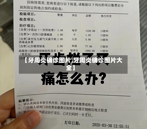 【牙周炎确诊图片,牙周炎确诊图片大全】-第3张图片