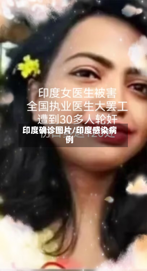 印度确诊图片/印度感染病例