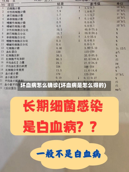 坏血病怎么确诊(坏血病是怎么得的)-第2张图片