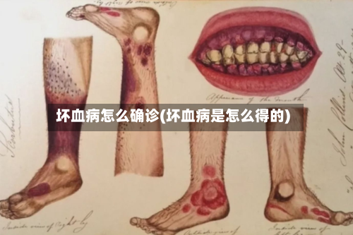 坏血病怎么确诊(坏血病是怎么得的)