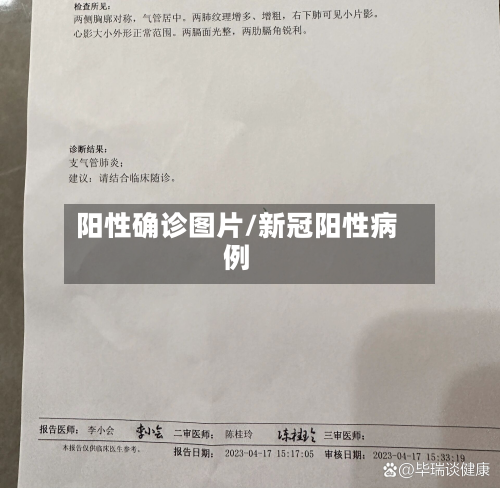 阳性确诊图片/新冠阳性病例-第3张图片