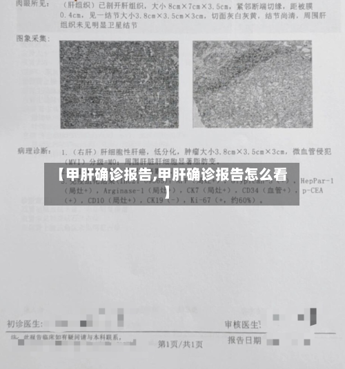 【甲肝确诊报告,甲肝确诊报告怎么看】