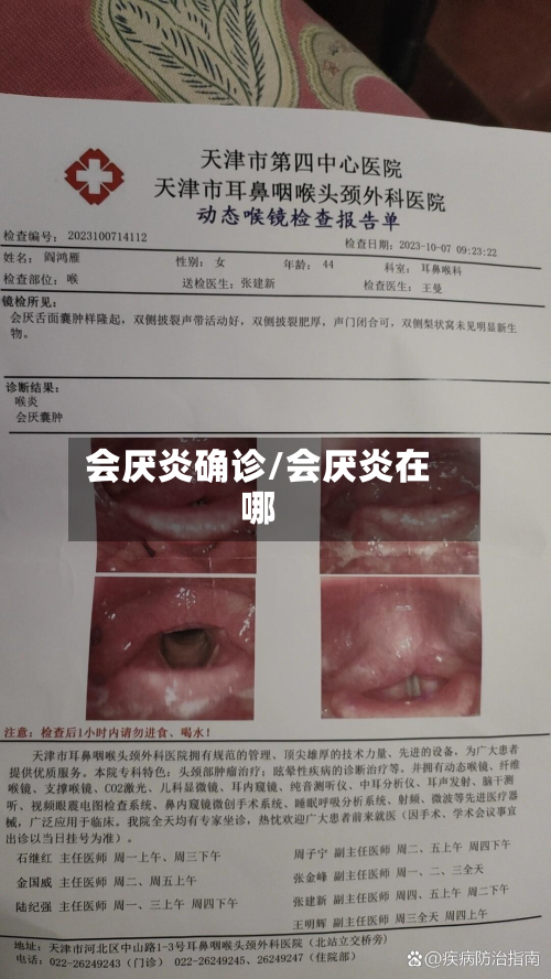 会厌炎确诊/会厌炎在哪