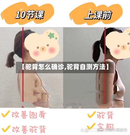 【驼背怎么确诊,驼背自测方法】-第2张图片