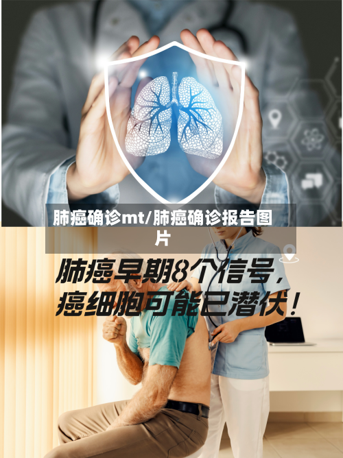 肺癌确诊mt/肺癌确诊报告图片