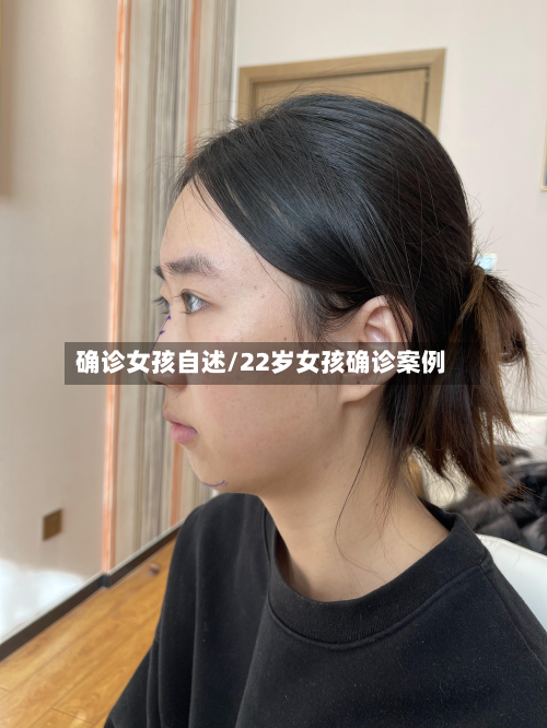 确诊女孩自述/22岁女孩确诊案例