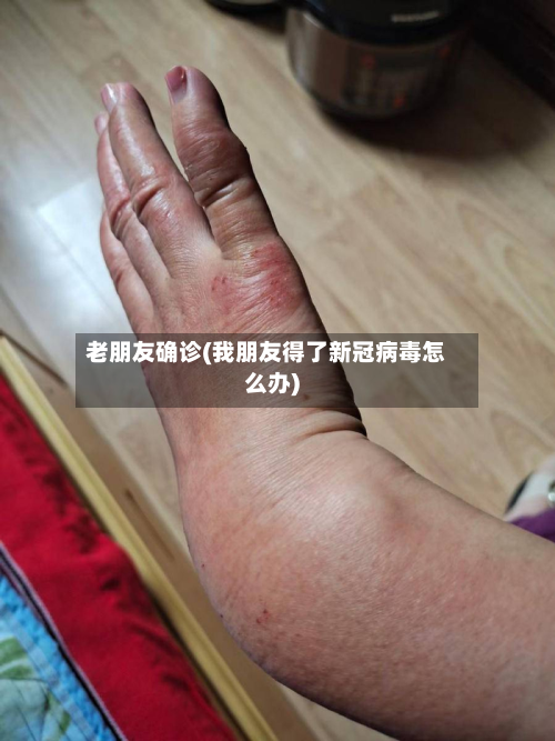 老朋友确诊(我朋友得了新冠病毒怎么办)