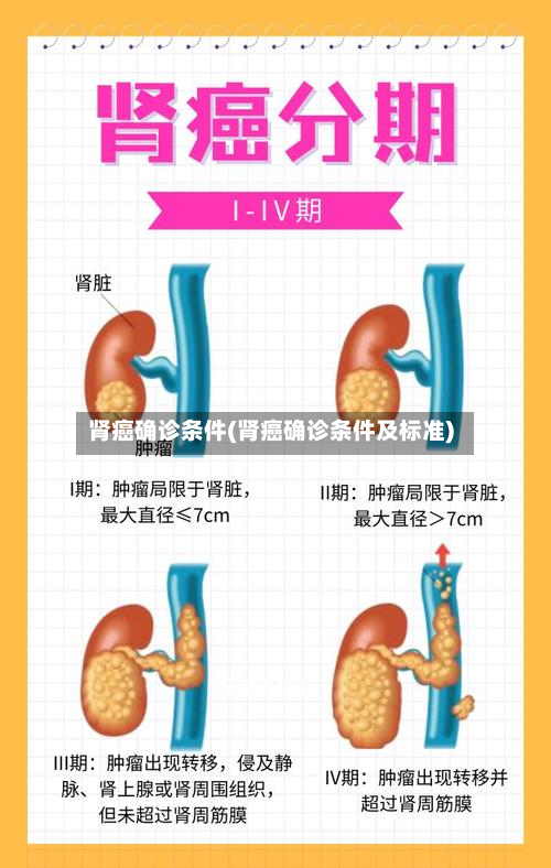肾癌确诊条件(肾癌确诊条件及标准)