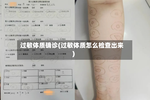 过敏体质确诊(过敏体质怎么检查出来)-第2张图片