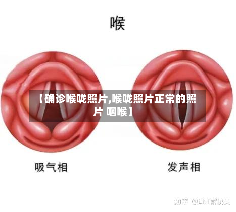 【确诊喉咙照片,喉咙照片正常的照片 咽喉】-第3张图片