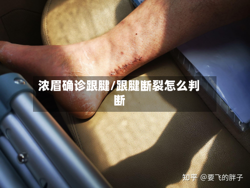 浓眉确诊跟腱/跟腱断裂怎么判断-第2张图片