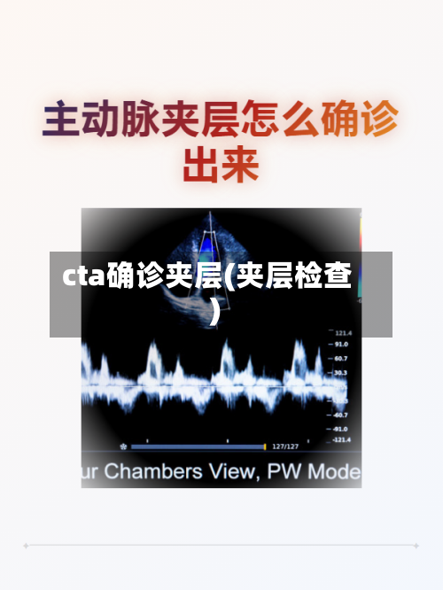 cta确诊夹层(夹层检查)-第3张图片